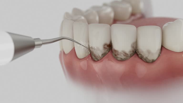 Reliable Dental contractor in Pataskala, OH by Smile Center Dentistry